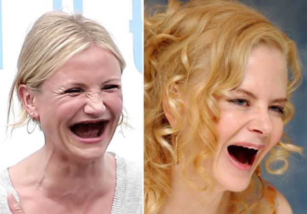 Celebrities-Without-Teeth-004