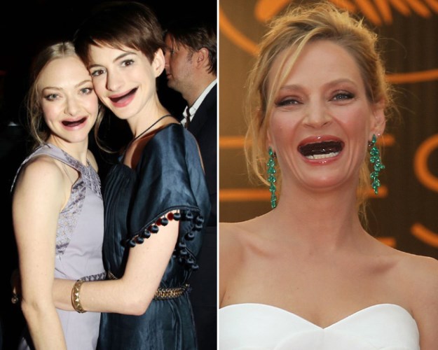 Celebrities-Without-Teeth-008