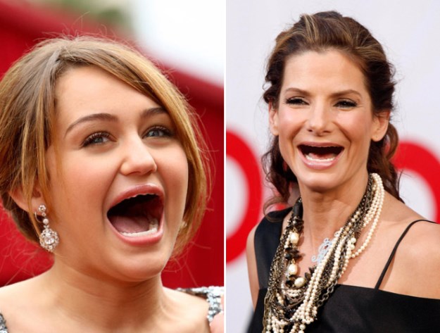 Celebrities-Without-Teeth-010