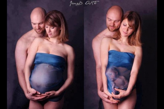 Totally-Embarrassing-Pregnancy-Announcements-011