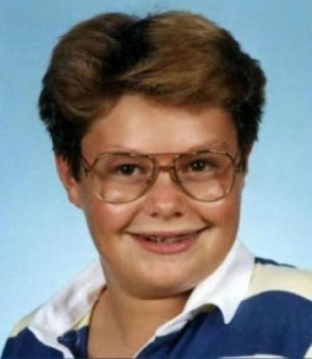 Celebrities-Wearing-Braces-002