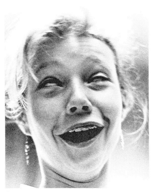 Celebrities-Wearing-Braces-004