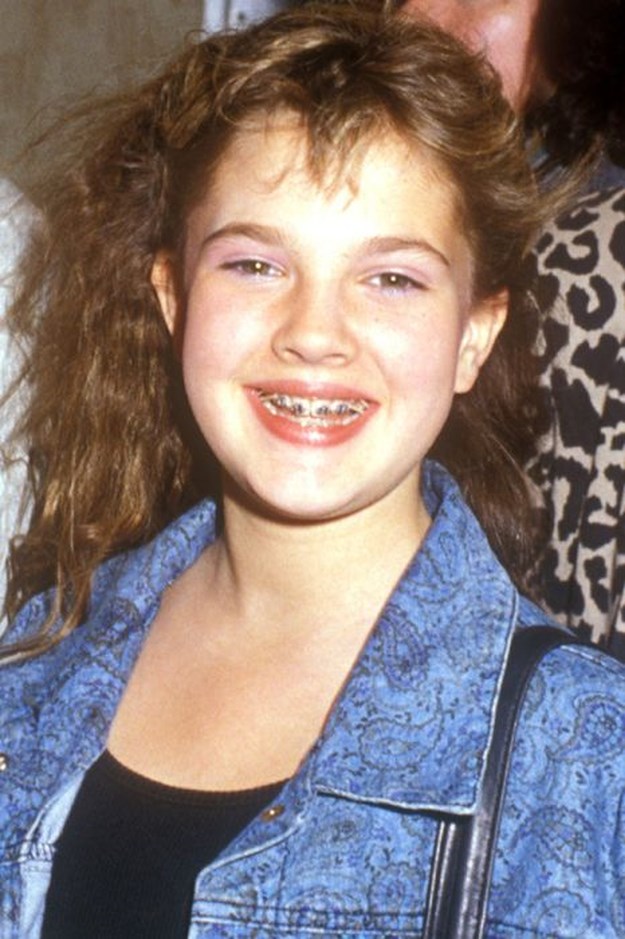 Celebrities-Wearing-Braces-006