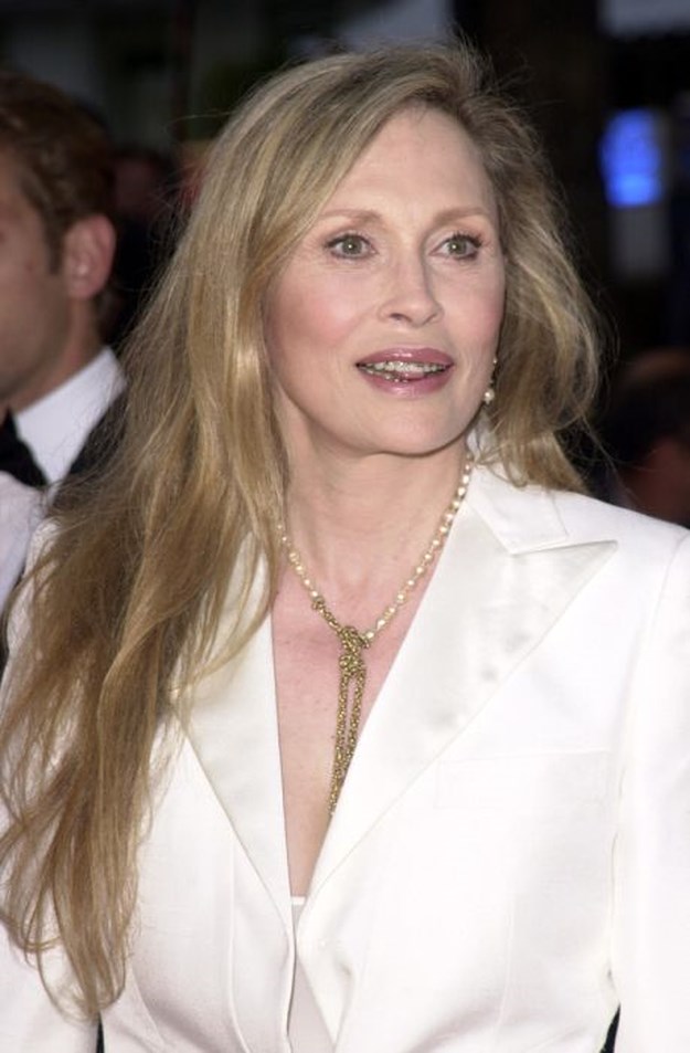 Celebrities-Wearing-Braces-007