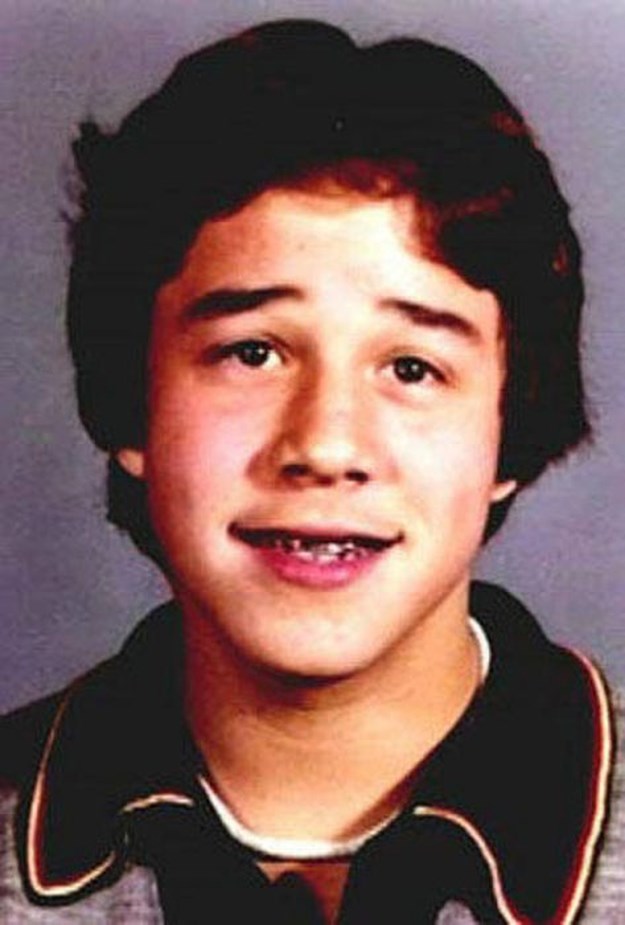 Celebrities-Wearing-Braces-008