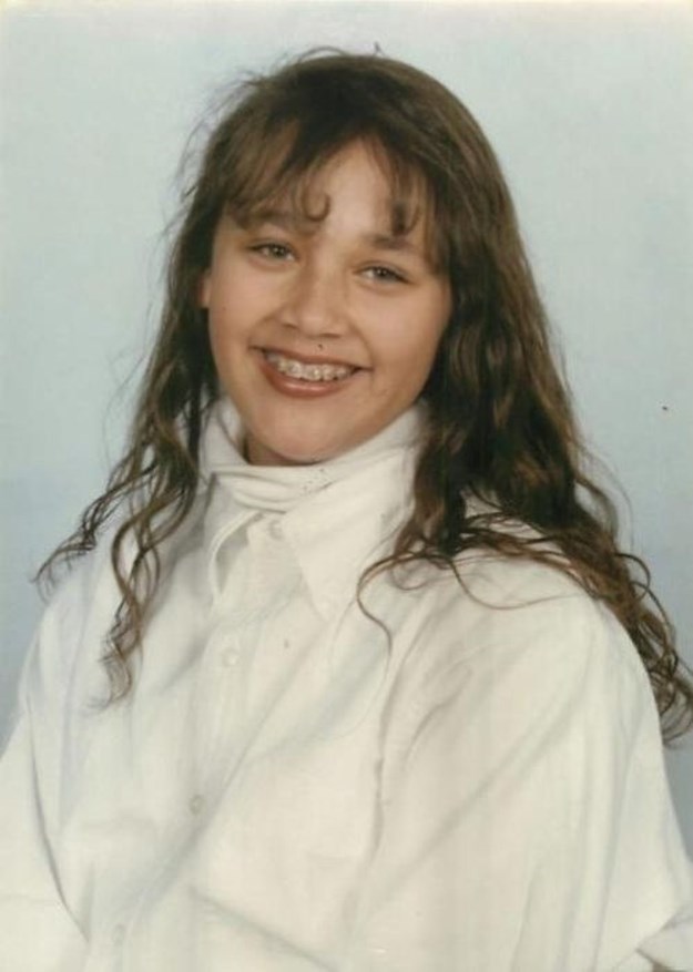 Celebrities-Wearing-Braces-009