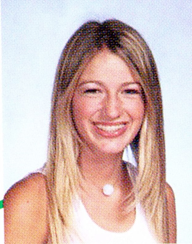 Celebrities-Wearing-Braces-010