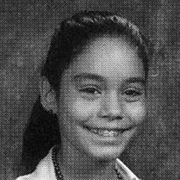 Celebrities-Wearing-Braces-016