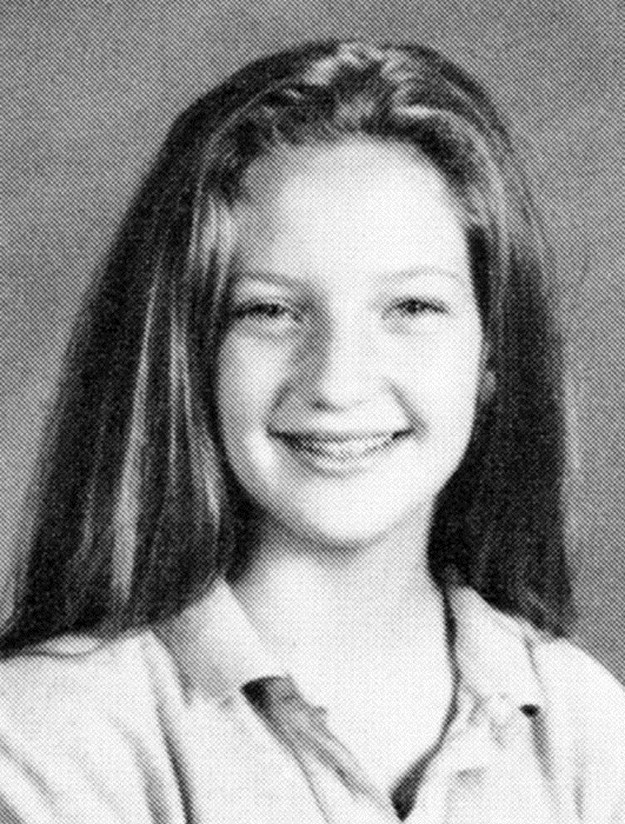 Celebrities-Wearing-Braces-018