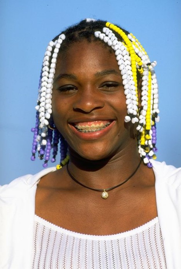 Celebrities-Wearing-Braces-020