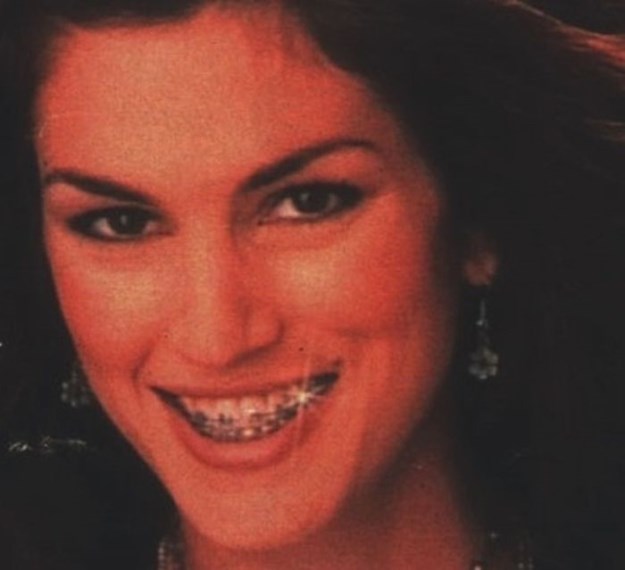 Celebrities-Wearing-Braces-021