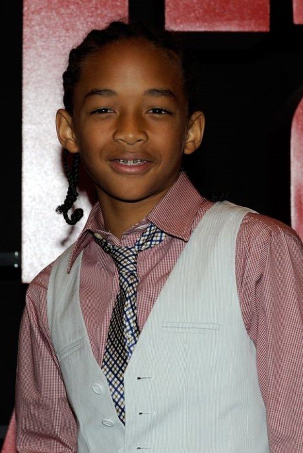 Celebrities-Wearing-Braces-023