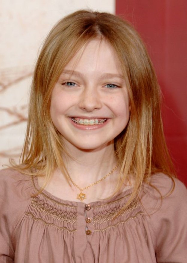 Celebrities-Wearing-Braces-025