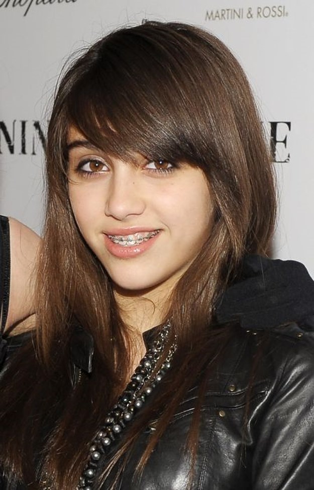 Celebrities-Wearing-Braces-031