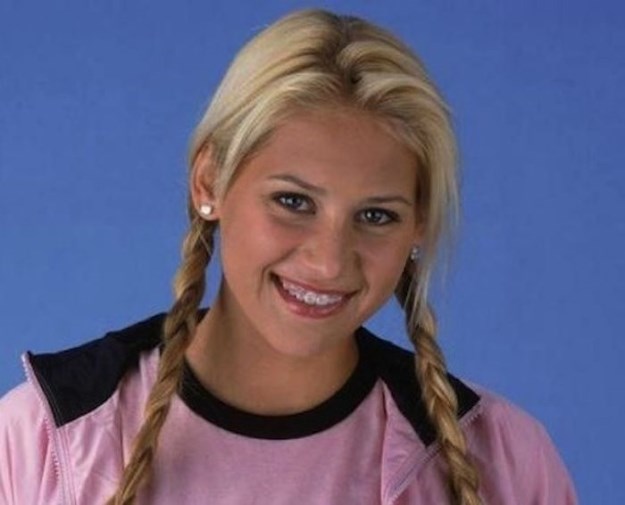Celebrities-Wearing-Braces-033