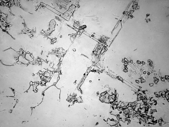 Dried-Human-Tears-Under-a-Microscope-004