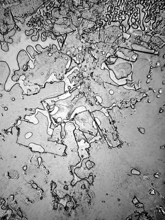 Dried-Human-Tears-Under-a-Microscope-007