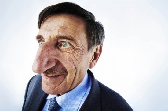 Mehmet Ozyurek - Longest Nose (8.8 cm)