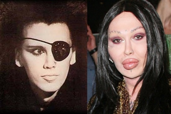10 Famous But Worst Examples of Plastic Surgery Ever - FunCage
