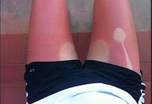 20 most epic tanning fails  002