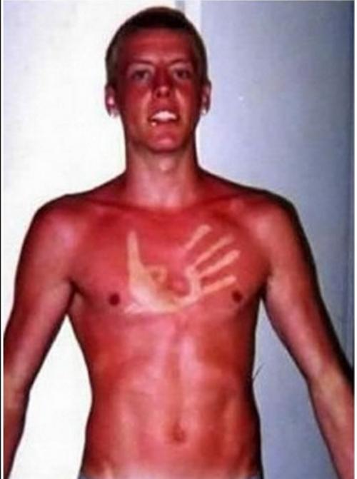 20 most epic tanning fails  005