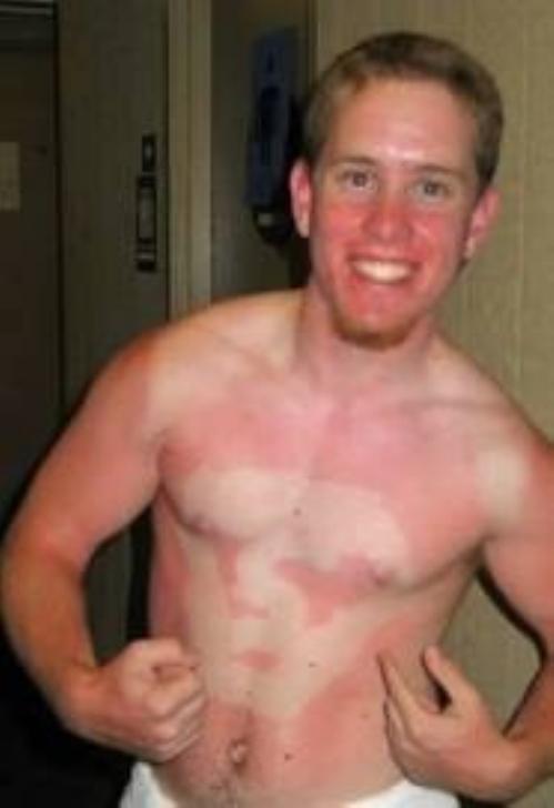 20 most epic tanning fails  010