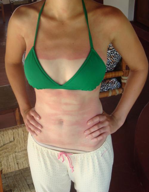 20 most epic tanning fails  015