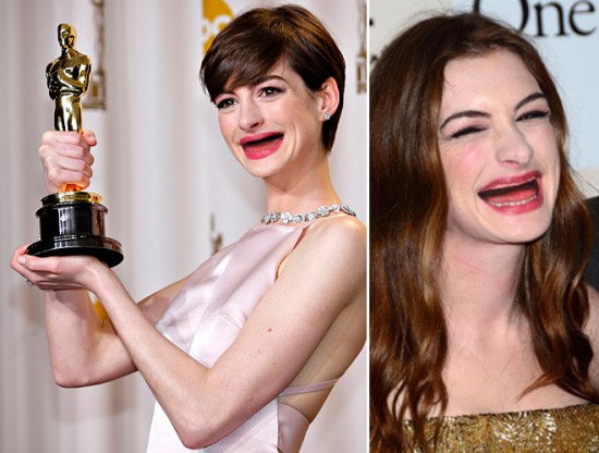 Celebrities With No Teeth 002