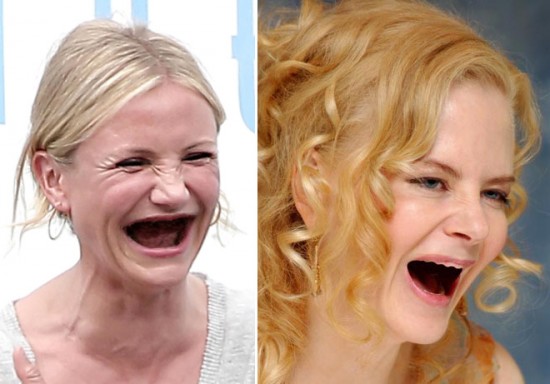 Celebrities With No Teeth 004