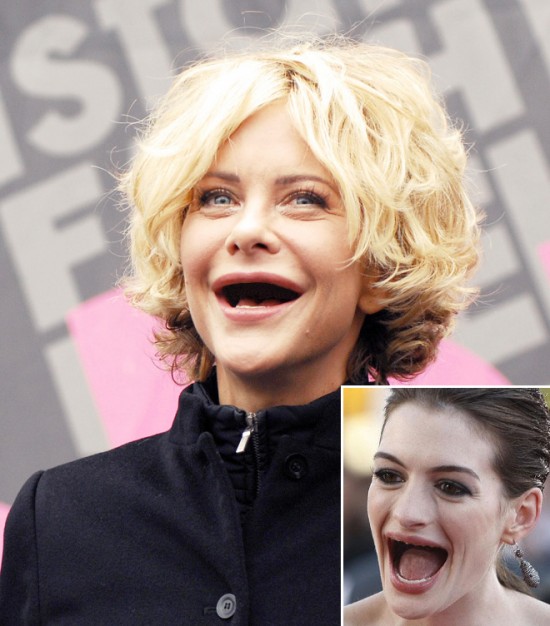 Celebrities With No Teeth 007