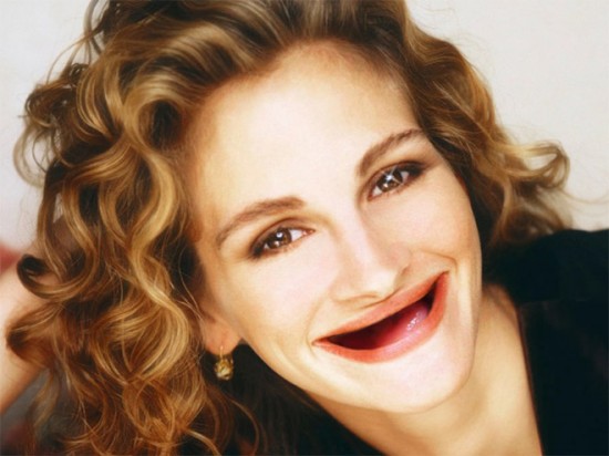Celebrities With No Teeth 008
