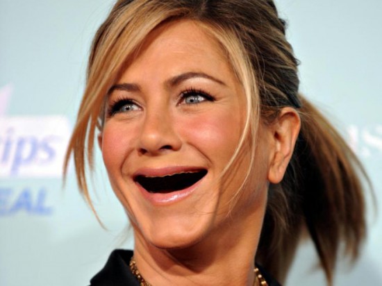 Celebrities With No Teeth 011