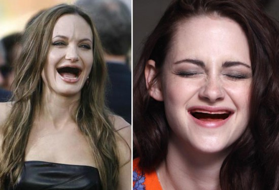 Celebrities With No Teeth 012