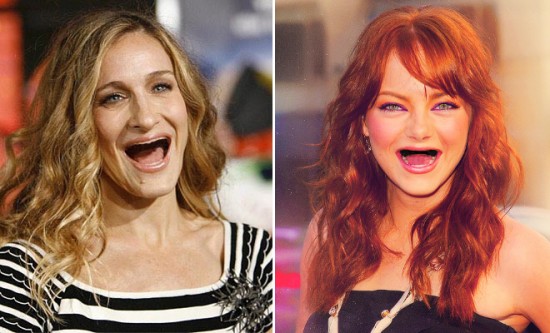 Celebrities With No Teeth 014