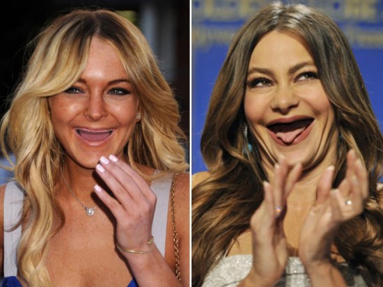 Celebrities With No Teeth 016