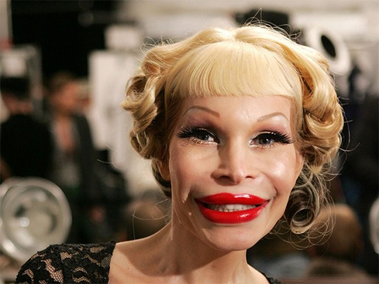 Plastic Surgery Gone Wrong 007