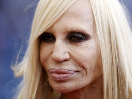 Plastic Surgery Gone Wrong 009