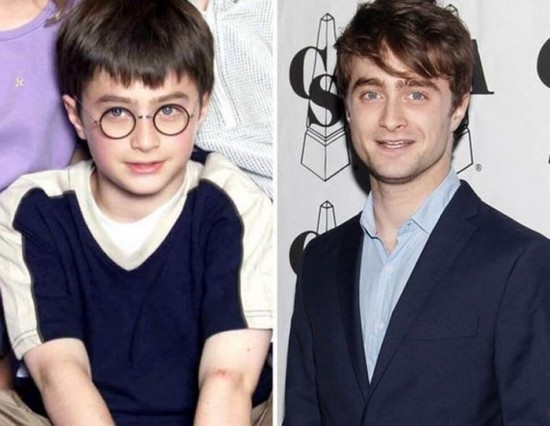 Daniel Radcliffe – 2000 and now